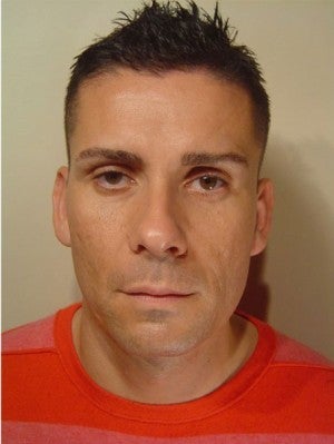 25-34 year old man treated with Botox after 3406110