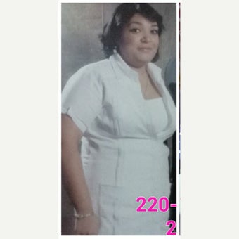 25-34 year old woman treated with Sleeve Gastrectomy before 2473293