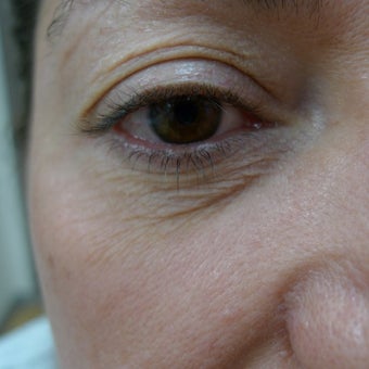 It is in the eyes... before 2250784
