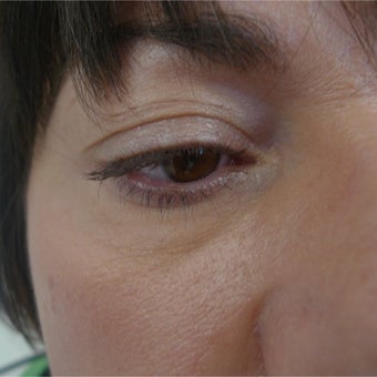 It is in the eyes... after 2250784