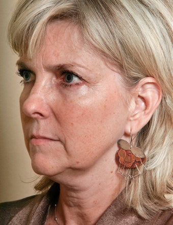 Necklift before 1018062
