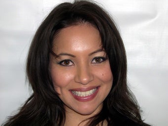 A Woman who Desired a Very White Smile Without Bleaching before 1324033