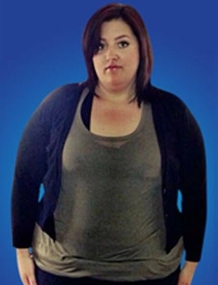 18-24 year old woman treated with Sleeve Gastrectomy before 1633817