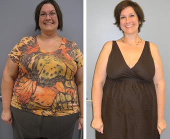 Before & After before 1104614