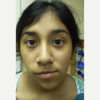 17 or under year old woman treated with Facial Reconstructive Surgery before 3696208