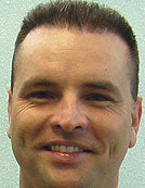 UGraft FUE-BHT hair transplantation using head and body hair after 195015
