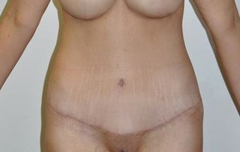 25-34 year old woman treated with Weight Loss after 1807149