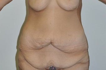 25-34 year old woman treated with Weight Loss before 1807149