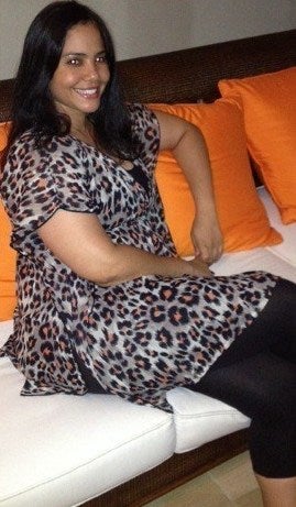 female treated with sleeve gastrectomy before 1239636