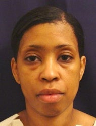 Lower Eyelid Surgery - Blepharoplasty before 886780