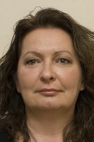 Injectable Fillers after 1076894