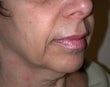 48 year old female patient 923007
