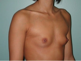 28 year old female patient 664218