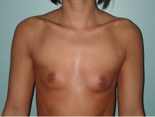 28 year old female patient before 664218