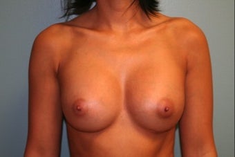 28 year old female patient after 664218