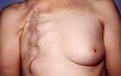 62 year old female patient before 934527