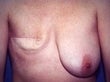 36 year old female patient before 934514