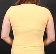 Bra Line Back Lift 567577