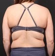 Bra Line Back Lift before 567577