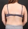 Bra Line Back Lift after 567577