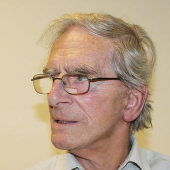 75 and up year old man treated with Facelift after 2278088