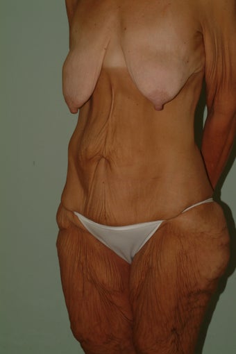 Total body makeover 1059180
