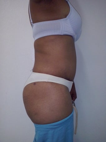 27 years old woman 1425298