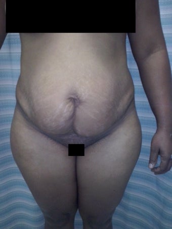 27 years old woman before 1425298