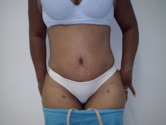 27 years old woman after 1425298