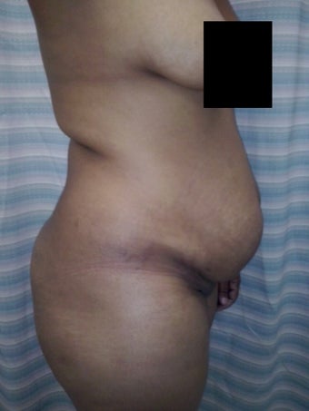 27 years old woman 1425298