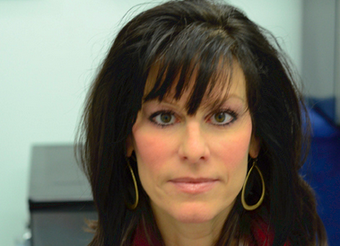 Cheek augmentation and cheek enhancement after 1183030
