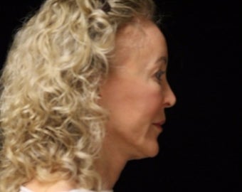 65-74 year old woman treated with Facelift, quad blepharoplasty before 2509133