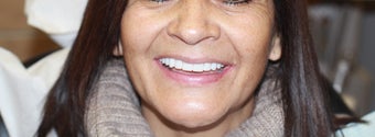 All-on-4® Treatment Protocol after 1222159