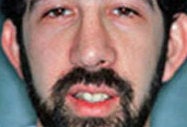 Ear Surgery for Men before 973994