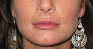 Injectables before 112087