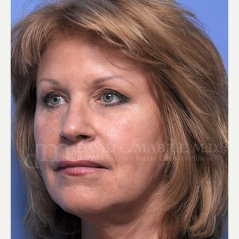 Under Eye Treatment 1842915