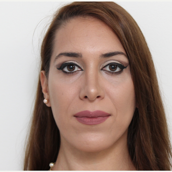 25-34 year old woman treated with Rhinoplasty after 3406454