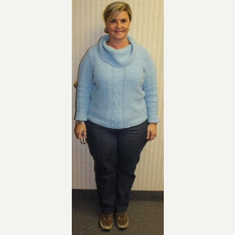 45-54 year old woman treated with Sleeve Gastrectomy before 2026440