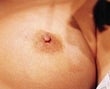 23 year old female patient after 933181