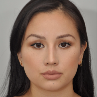 25-34 year old woman treated with Asian Rhinoplasty after 3524670