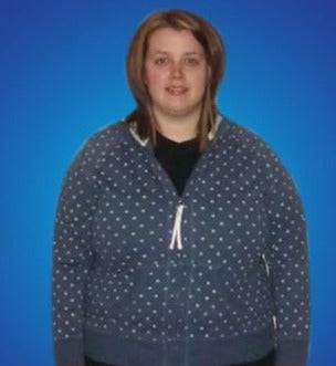 25-34 year old woman treated with Laparoscopic Gastric Bypass before 1704447