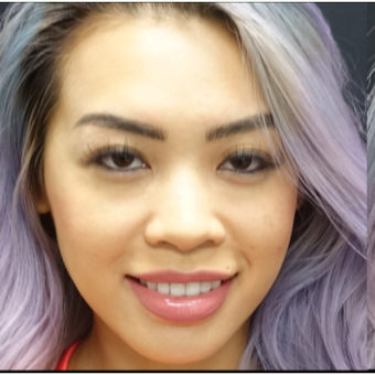 25-34 year old woman treated with Non Surgical Nose Job before 3152188