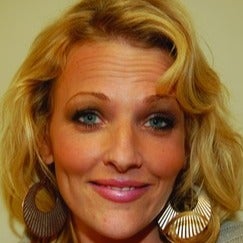 Botox before 1605466