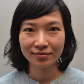 25-34 year old woman treated with Rhinoplasty before 3747698
