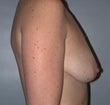 42 year old female patient 911391