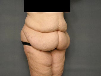 Age: 52, Height: 5"10", Weight: 236lbs. 1306678