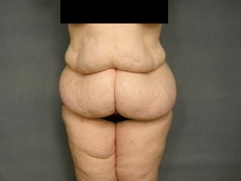 Age: 52, Height: 5"10", Weight: 236lbs. before 1306678