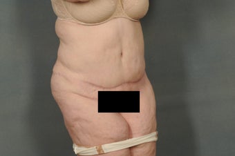 Age: 52, Height: 5"10", Weight: 236lbs. 1306678