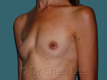 Slim Athletic Body and Breast Type before 930266