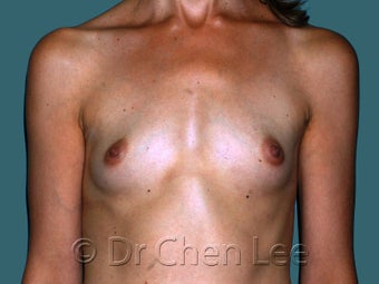 Slim Athletic Body and Breast Type 930266